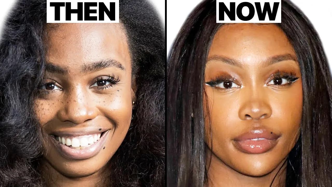 Sza surgery
